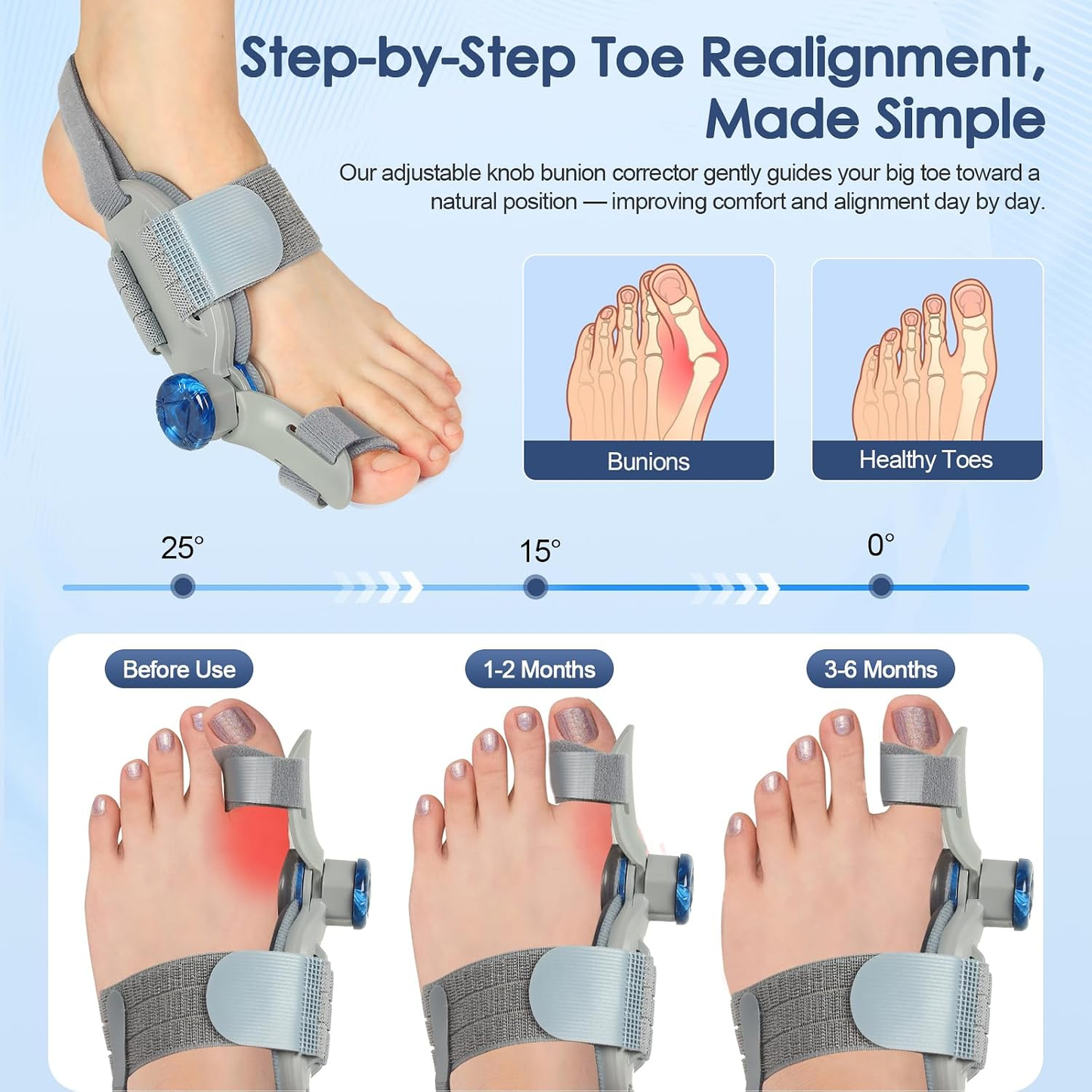🔥Unisex Bunion Corrector (with Adjustable Knob)
