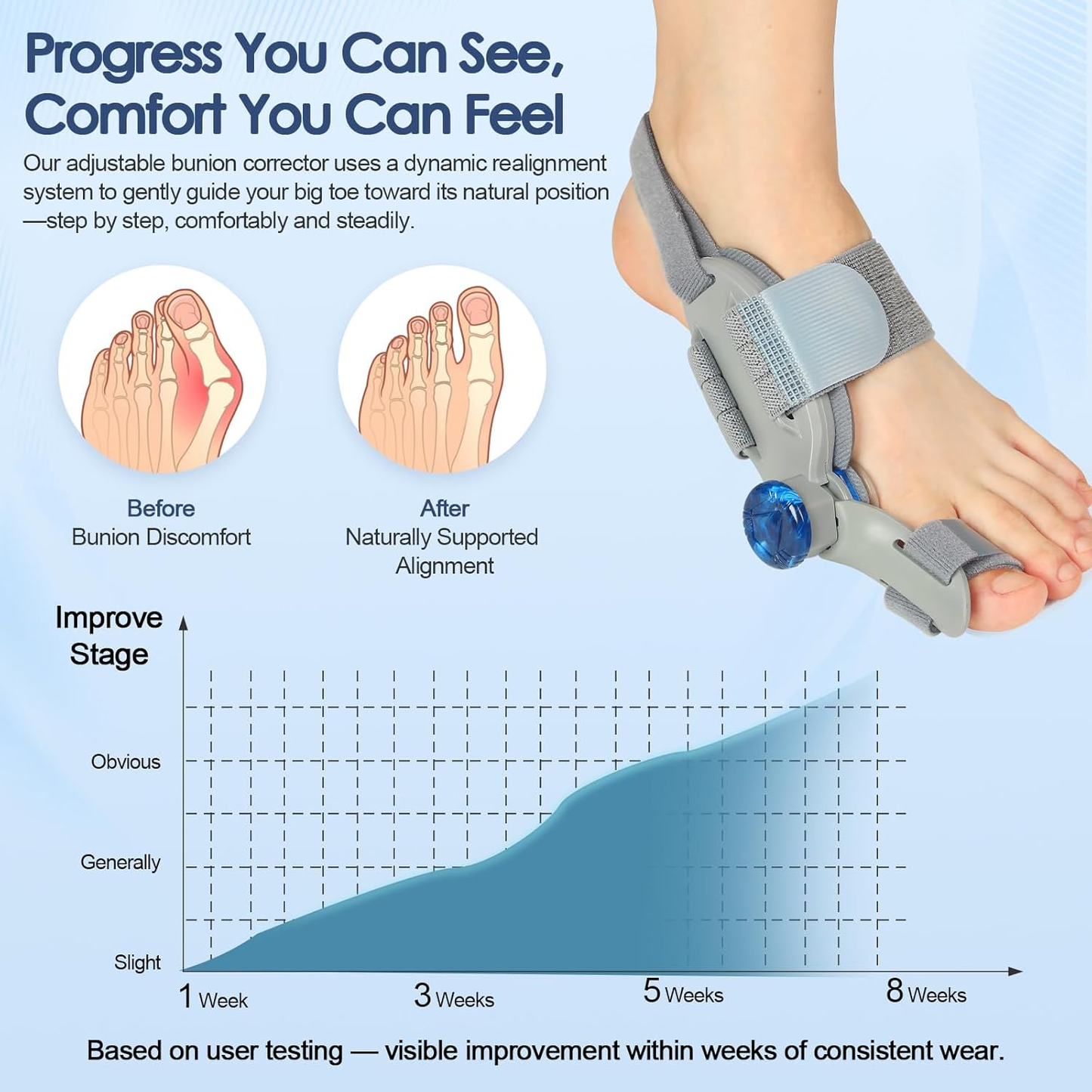 🔥Unisex Bunion Corrector (with Adjustable Knob)